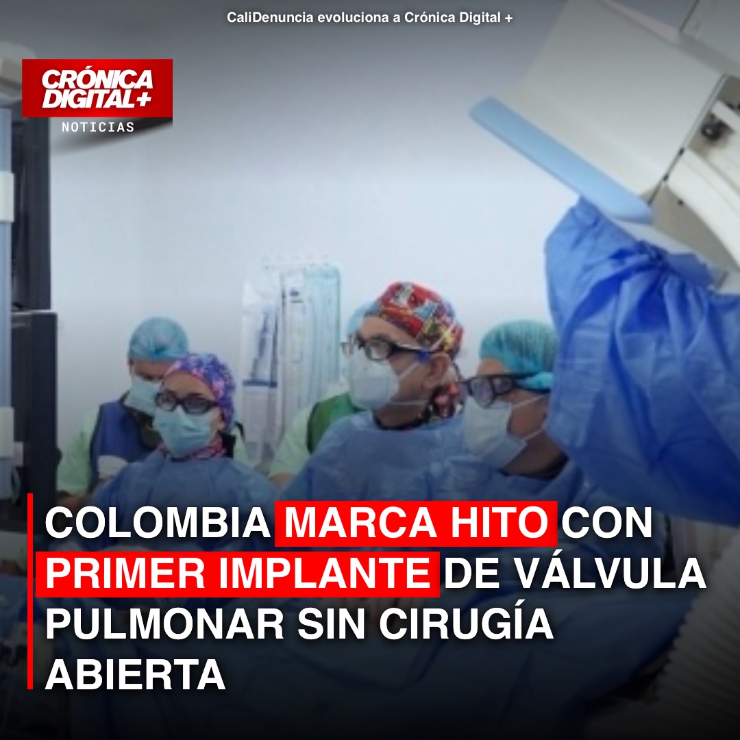Colombia: Implante sin cirugía de válvula pulmonar Harmony marca avance cardíaco