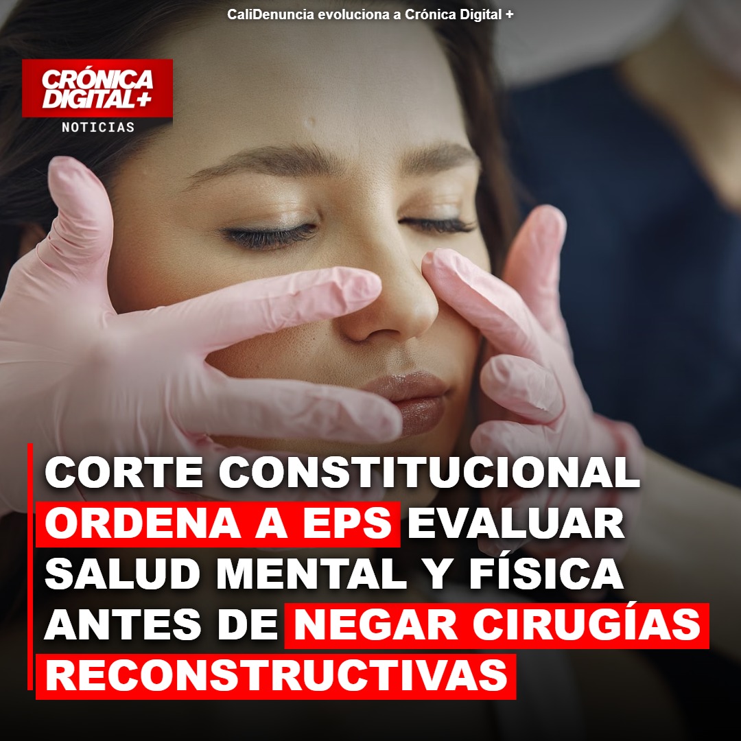 Corte Constitucional ordena a EPS evaluar salud mental antes de negar cirugías