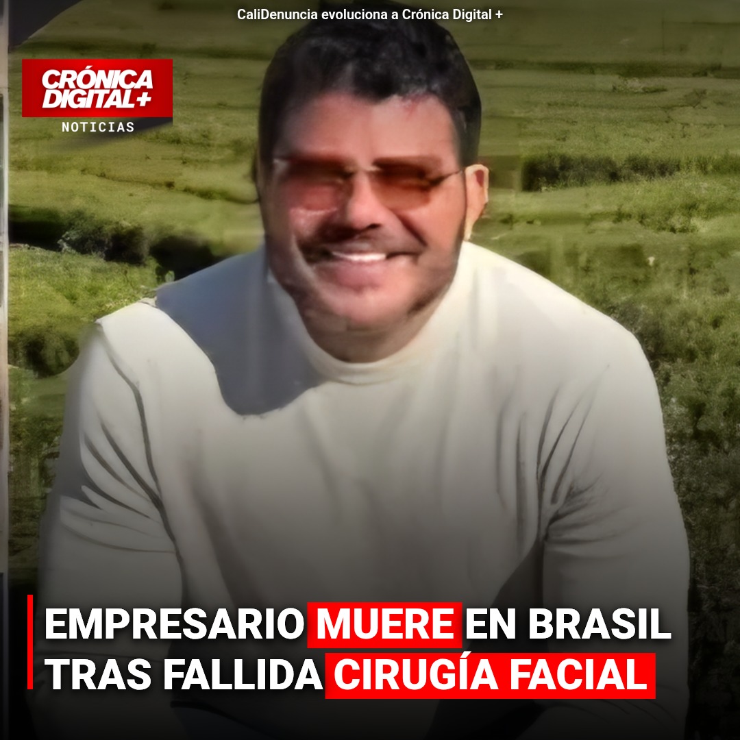 Empresario brasileño muere en cirugía facial: investigan negligencia