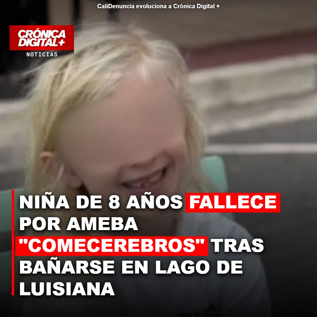 Niña de 8 años fallece en Luisiana por ameba «comecerebros»
