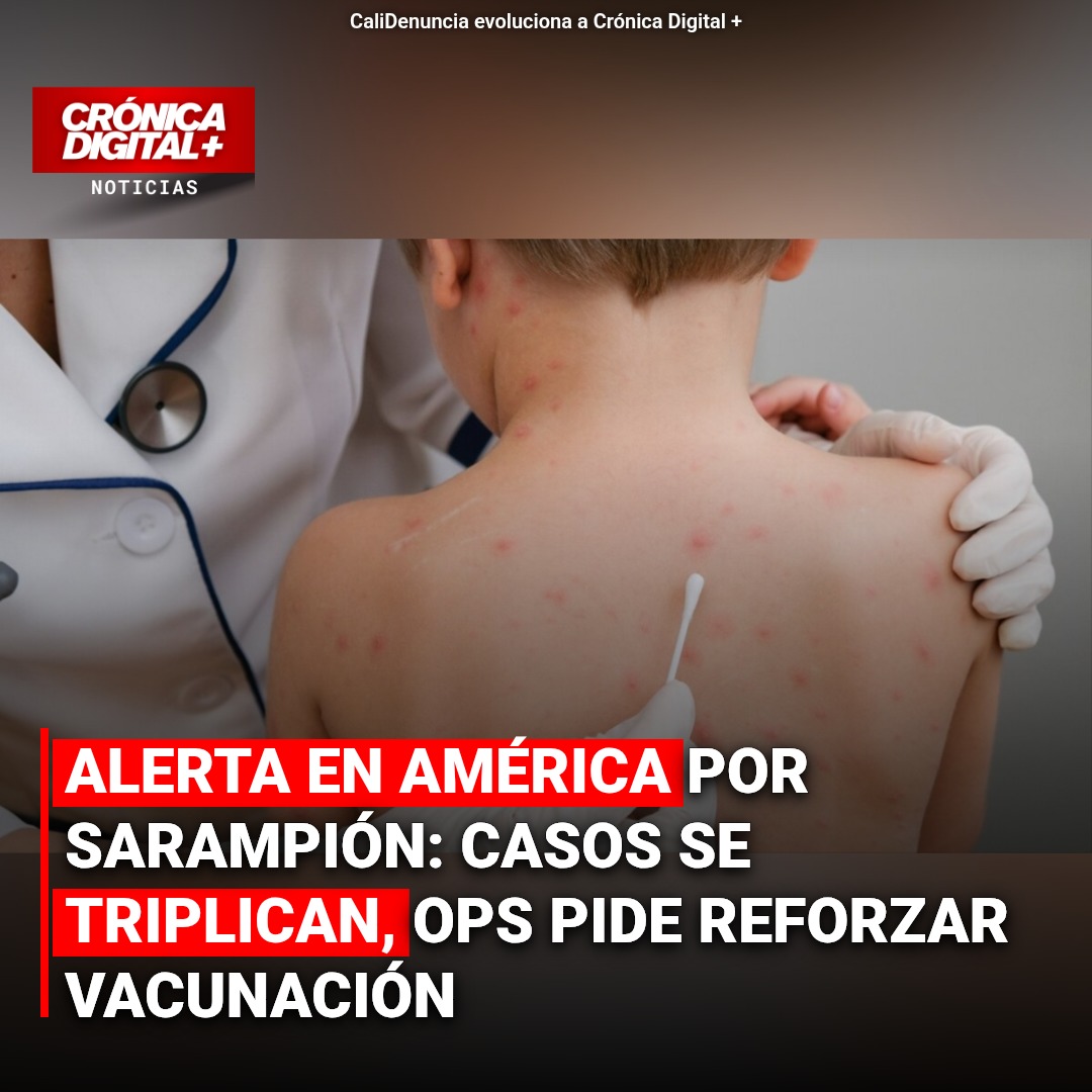 Sarampión en América: casos se disparan, OPS insta a reforzar vacunación