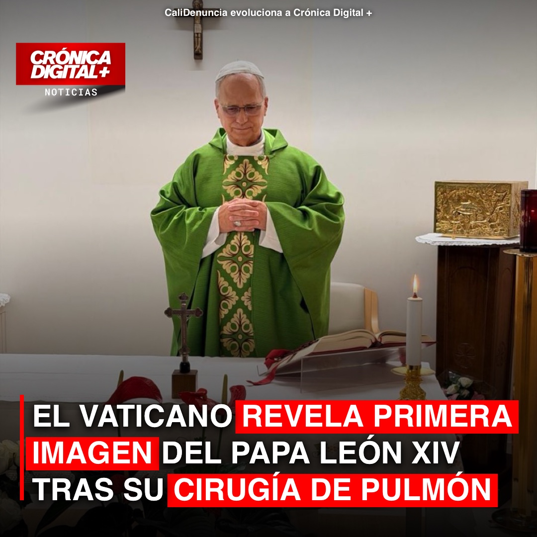 El Vaticano revela primera imagen del papa León XIV tras su cirugía de pulmón