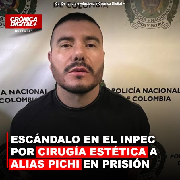 Escándalo en el Inpec por cirugía estética a alias Pichi en prisión